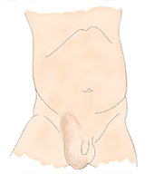 水腫 いん の 大人 う