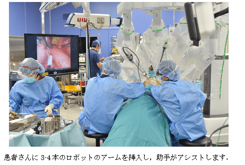 患者さんに３-4本のロボットのアームを挿入し、助手がアシストします。