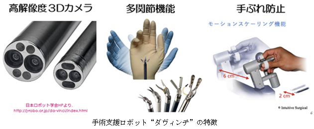手術支援ロボット“ダ・ヴィンチ”の特徴